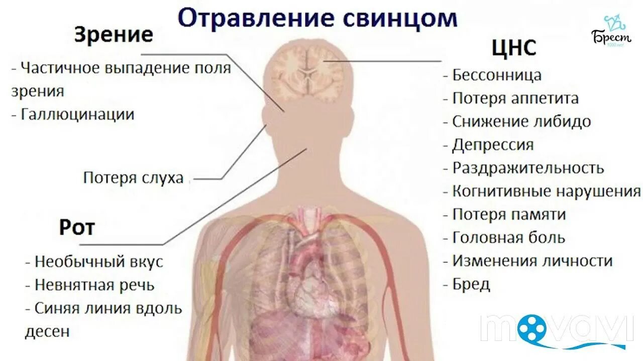 Интоксикация давление. Отравление свинцом симптомы. Симптомы воздействия свинца. Симптомы действия свинца. Симптомы свинцовой интоксикации.