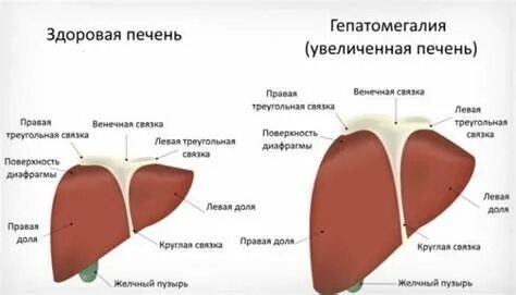 Увеличилась печень симптомы