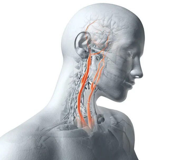 Сосуды головы и шеи. Кровеносные сосуды шеи и головы. Заболевания брахиоцефальных артерий. Болезни сосудов головы