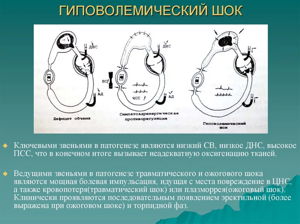 Гиповолемический ШОК. Причины развития гиповолемического шока. Гиповолемический ШОК механизм. Гиповолемический геморрагический ШОК. Помощь при гиповолемическом шоке