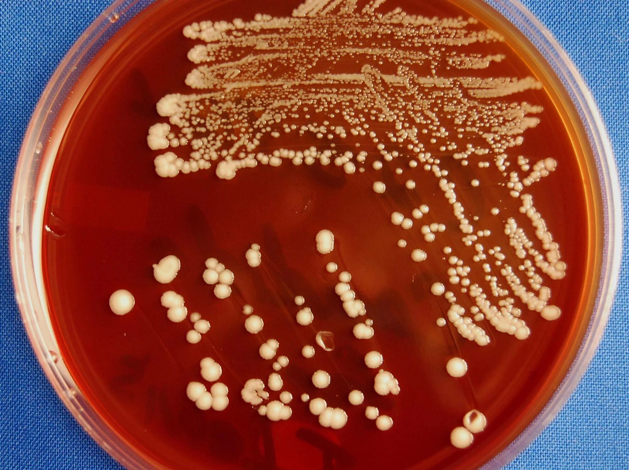 Дрожжеподобные грибы candida