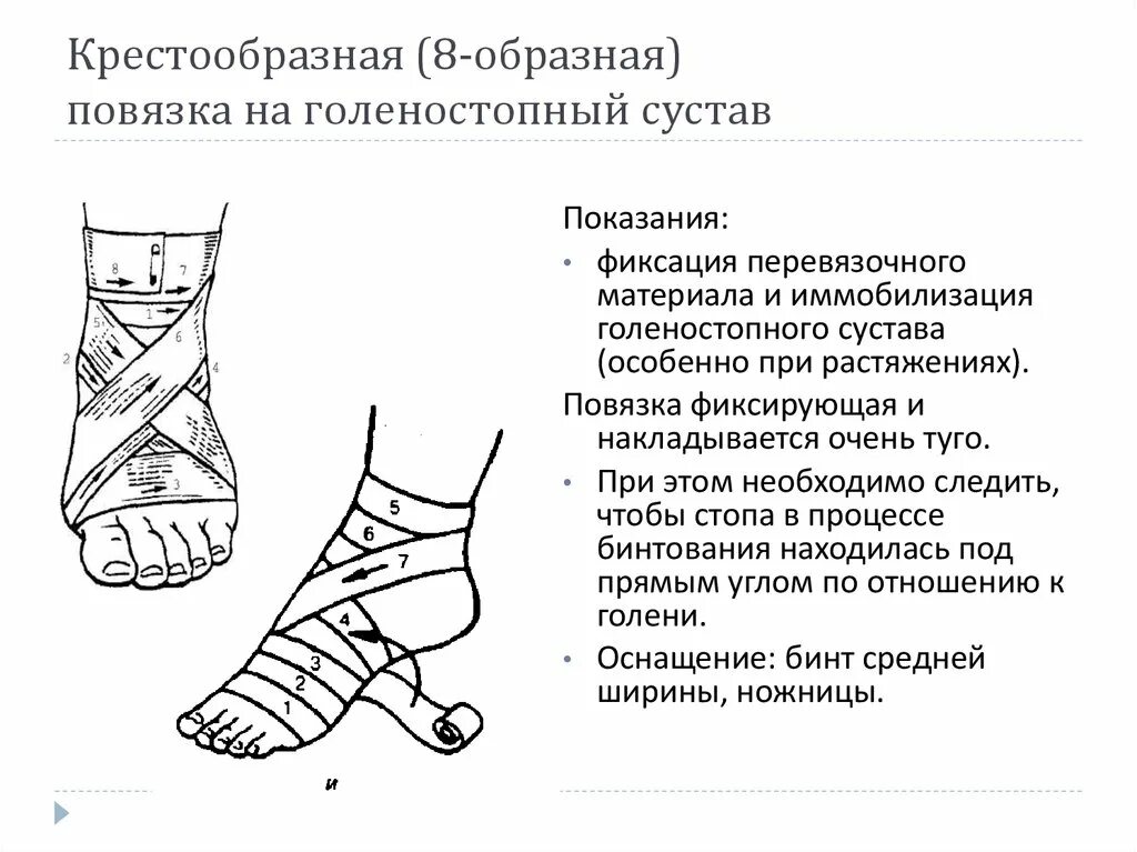 Техника наложения восьмиобразной повязки на голеностопный сустав. Технику наложения 8-образной повязки на голеностопный сустав.. Повязка восьмиобразная на голеностопный сустав цель. Фиксирующая повязка на голеностопный сустав техника наложения. Наложение эластичного бинта на конечность