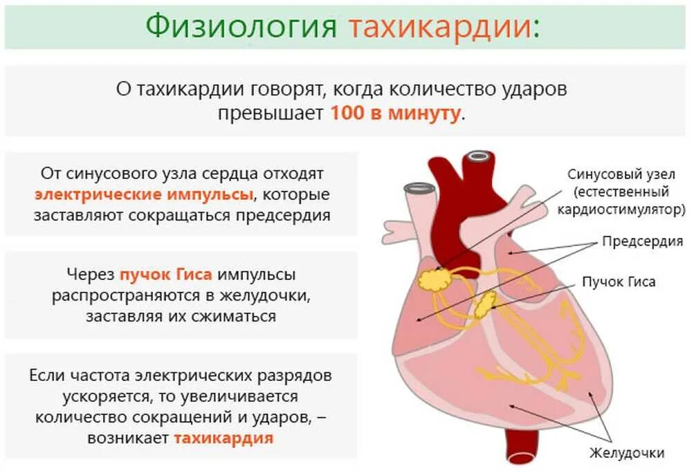 Тахикардия. Тахикардия сердца симптомы. Учащенное сердцебиение тахикардия. Тахикардия физиология. Почему бьется пульс