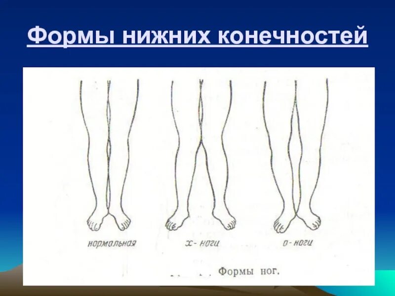 Форма ноги человека