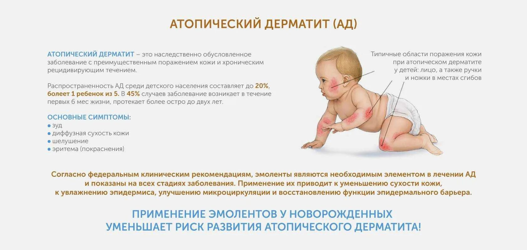Дерматит у детей причины возникновения и лечение