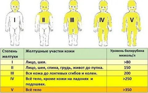 Лампа снижающая билирубин