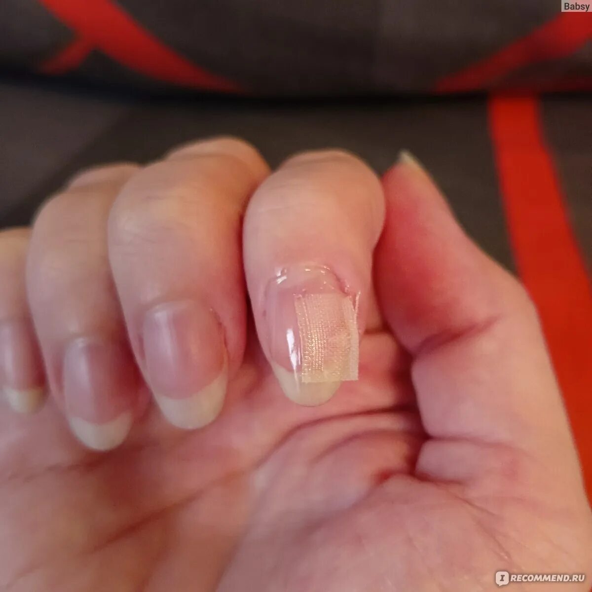 Отходит гель лак что делать. Отходит гель лак что делать. Отслойки на ногтях гель лака. Отслойка нарощенных ногтей. Гель лак отходит от ногтя с кончиков.