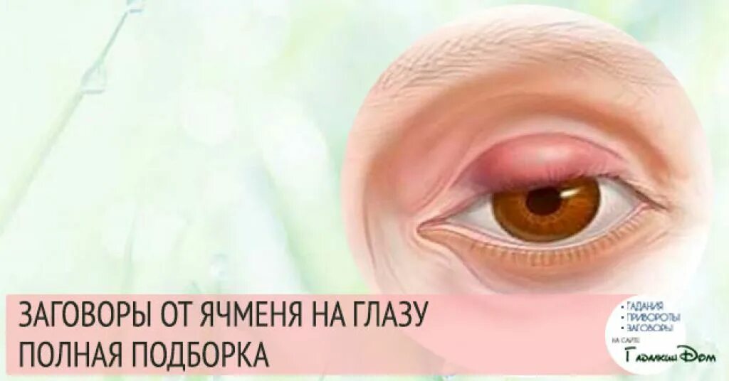 Ячмень психосоматика на глазу левом у женщины. Ячмень психосоматика причины. Ячмень психосоматика причины. Ячмень на глазу психосоматика. Заболевания век ячмень.