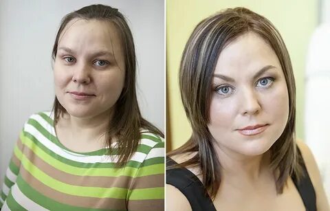 Полная коррекция