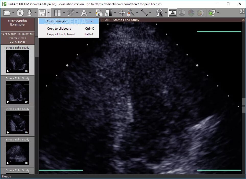 Dicom viewer. Dicom viewer 3.1.4. radiant dicom viewer 2025.2.3 serial number. radiant dicom viewer. radiant dicom viewer 2025.2.3 лицензионный ключ.