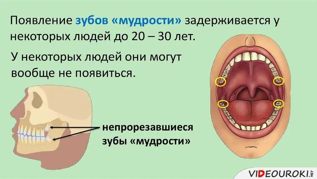 Во сколько вылезают зубы мудрости