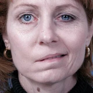 Частичный или полный паралич
