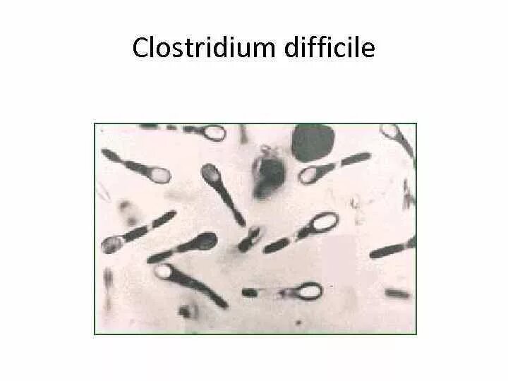 Морфология клостридиум диффициле. Морфология клостридий. Clostridium difficile микробиология.