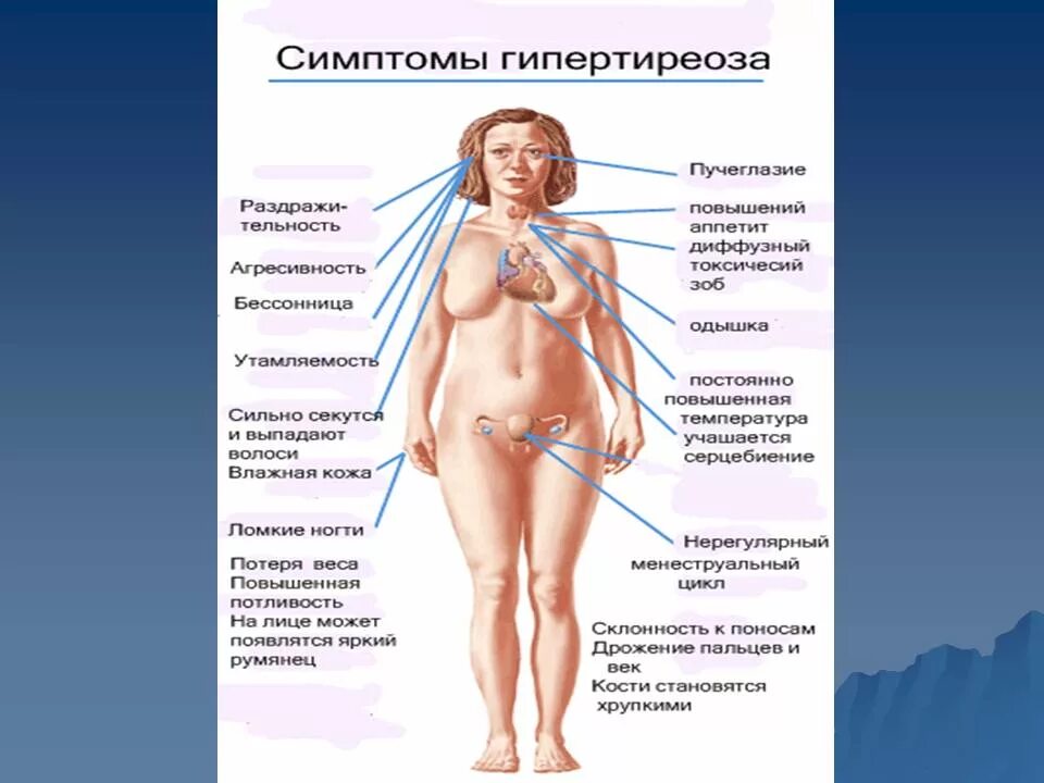 Половая система при гипертиреозе. Клинические проявления при гипотиреозе и гипертиреозе. Заболевания щитовидной железы (гипертиреоз, тиреотоксикоз).. Слабый диффузный