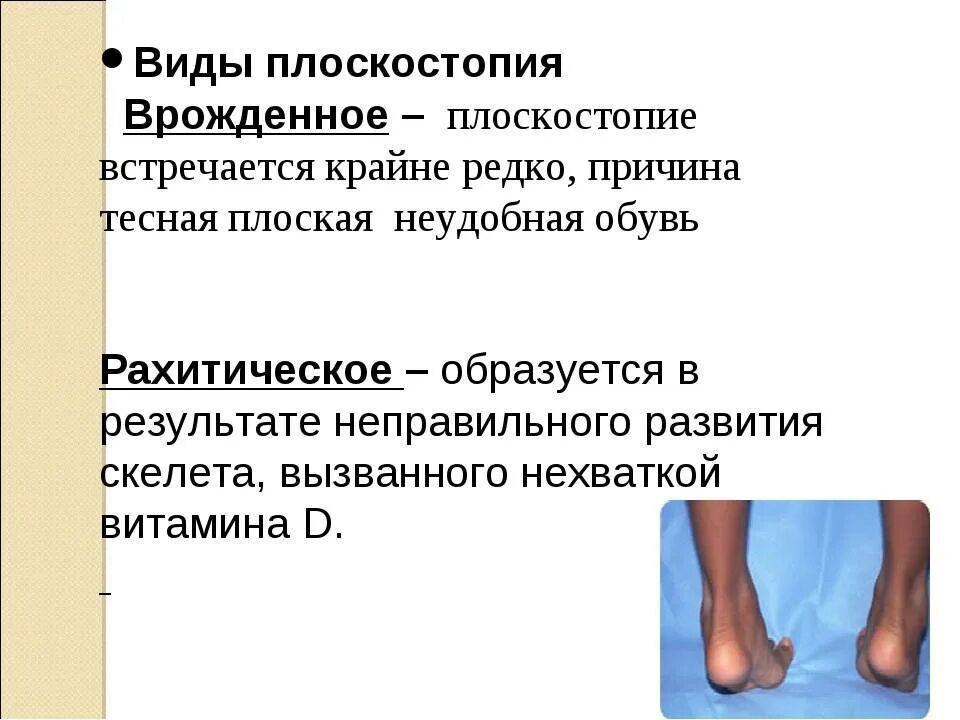 Плоская стопа. Причины плоскостопия. Плоскостопие презентация. Причины развития плоскостопия. Причины появления плоскостопия.