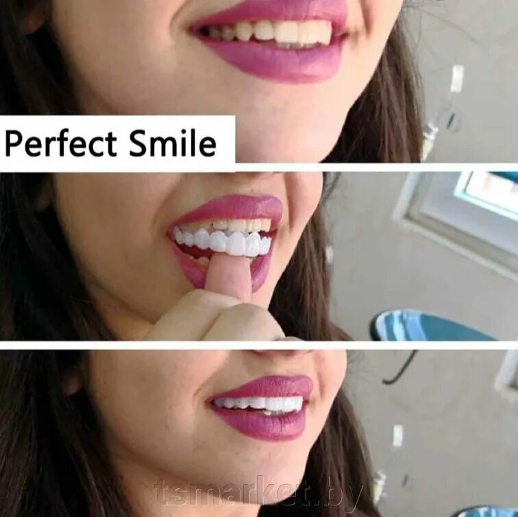 Готовы зубы. Накладные зубы snap on smile. виниры комплект snap-on smile. накладные зубы perfect smile veneers. cъемные виниры perfect smile veneer (snap on smile).