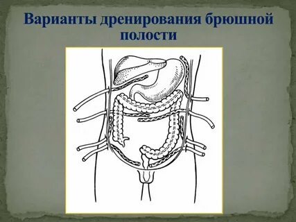 Операции брюшной