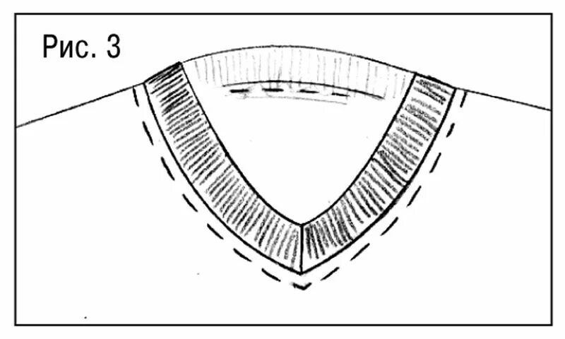 Срезы обтачек. V образная горловина с обтачкой. Обработка горловины платья обтачкой. Обработка горловины трикотажных изделий обтачкой. Обработка v образной горловины трикотажа обтачкой.