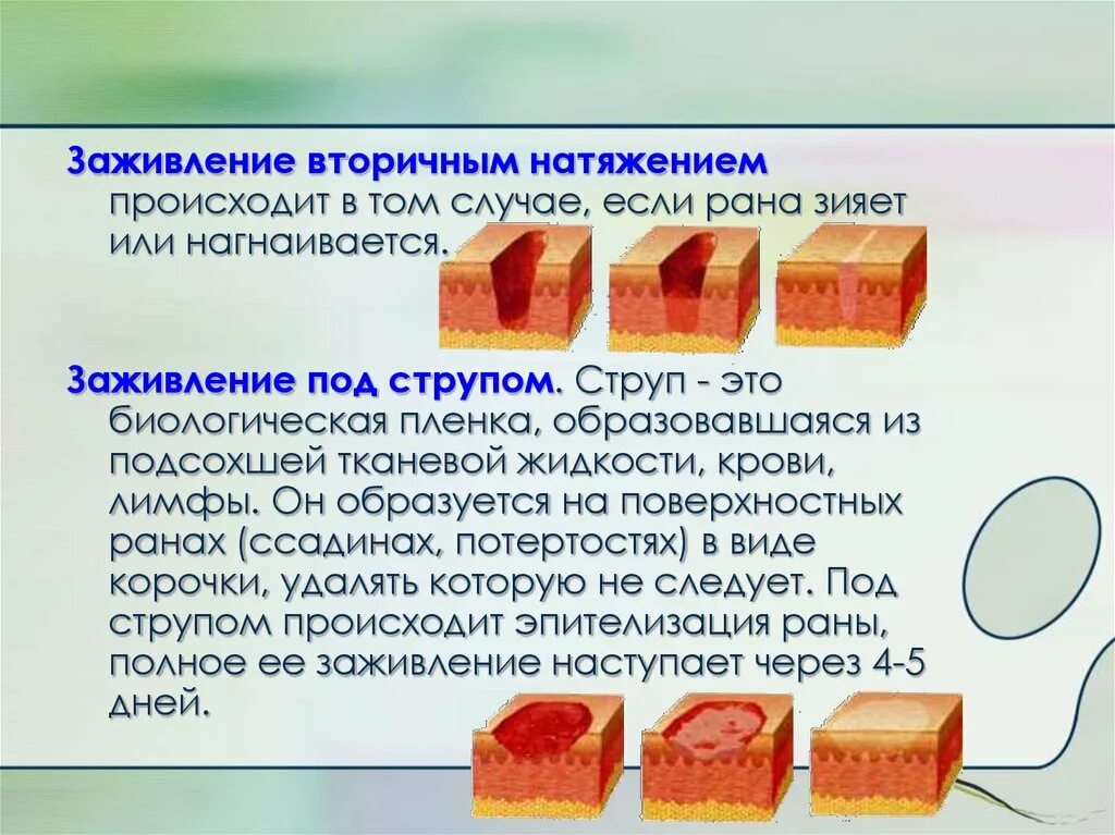 Через сколько заживает рана. Заживление РАН вторичным натяжением (ПАТ. Заживление РАН вторичным натяжением патанатомия. Заживление первичным и вторичным натяжением под струпом. Этапы заживления РАН вторичным натяжением.