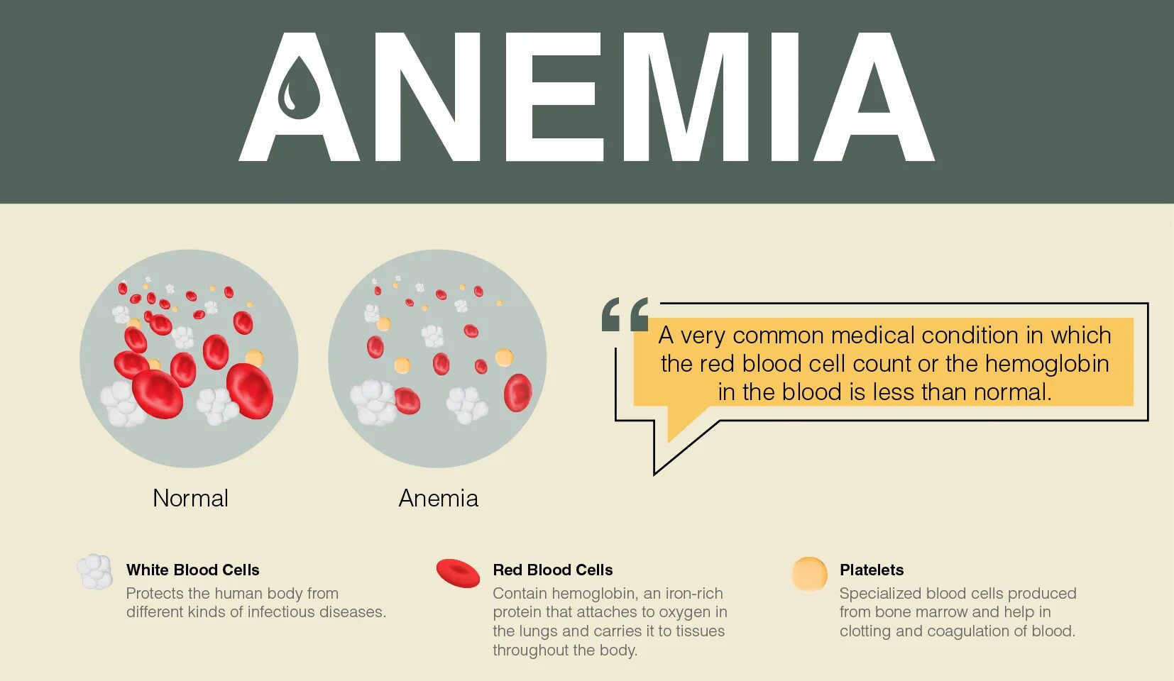 Types of anemia. Treatment for anemia?.