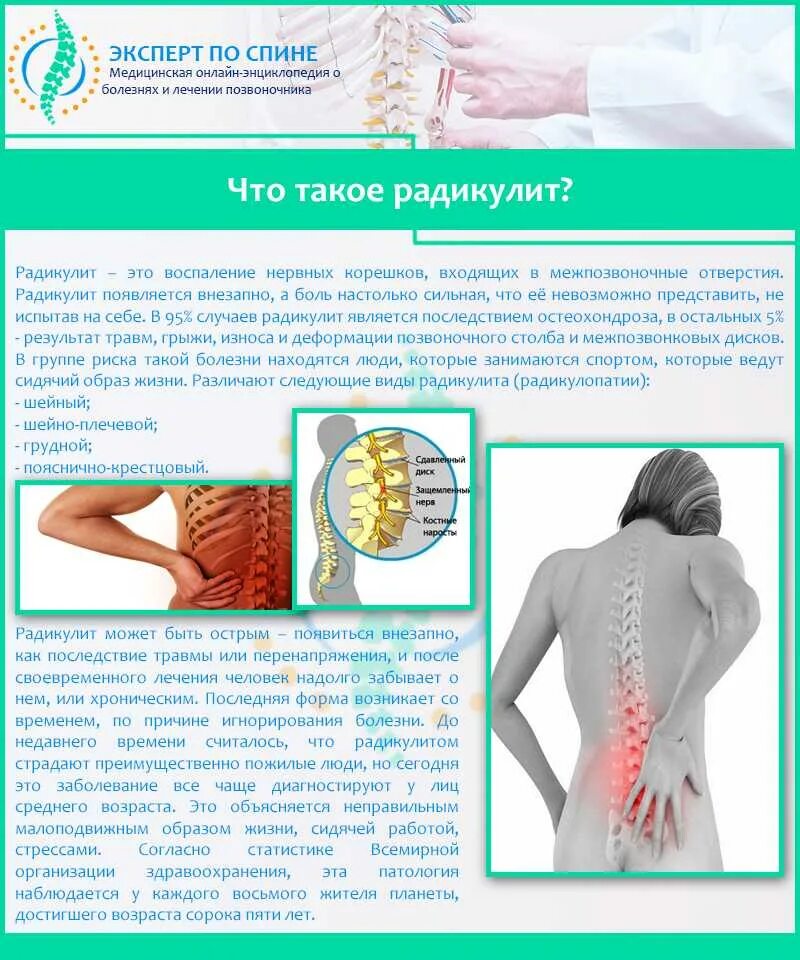 Признаки боли в пояснице. Пояснично-крестцовый радикулит симптомы. Клинический симптом пояснично-крестцового радикулита. Пояснично крестцовая радикулопатия. Корешковый. Синдром. Люмбалгия корешковый синдром.