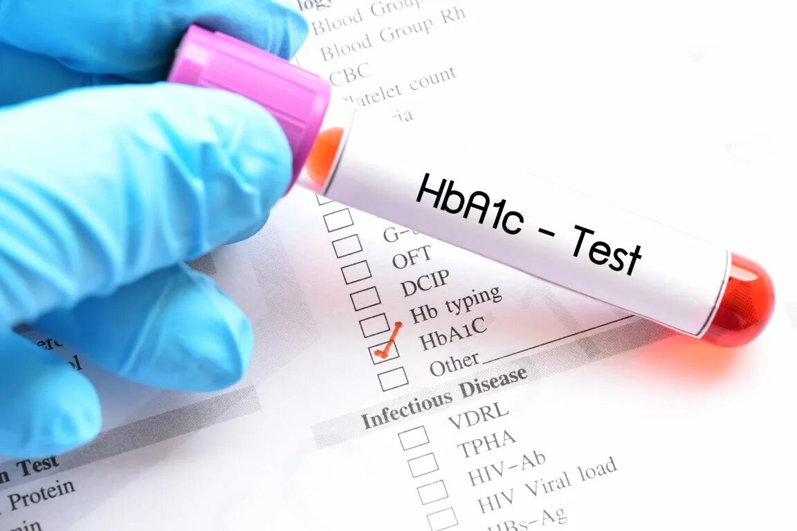 Тест гемоглобина в крови. Гликозилированный гемоглобин hba1c кровь. Hemoglobin a1c норма. Гликированный гемоглобин (hba1c). Hba1c (гликированный HB) 4.9.