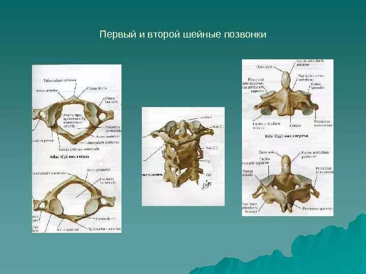 1 И 2 шейные позвонки. Анатомия 1 шейного позвонка рентген. С2 позвонок анатомия рентген. Эпистрофей строение. Характерные признаки шейного позвонка