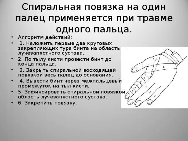 Повязка на кисть алгоритм. Повязка на 1 палец кисти алгоритм. Спиральная повязка на палец алгоритм. Наложение повязки на 1 палец кисти. Наложение повязки на палец руки алгоритм.