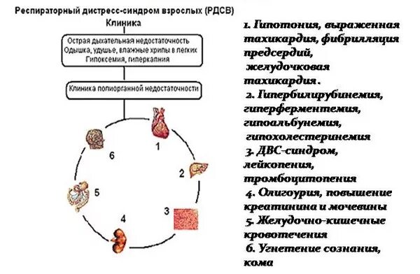 Респираторный дистресс синдром взрослых. Острый респираторный дистресс-синдром жалобы. Острый респираторный дистресс-синдром симптомы. Стадии развития острого респираторного дистресс-синдрома. Острый респираторный дистресс-синдром клиника.