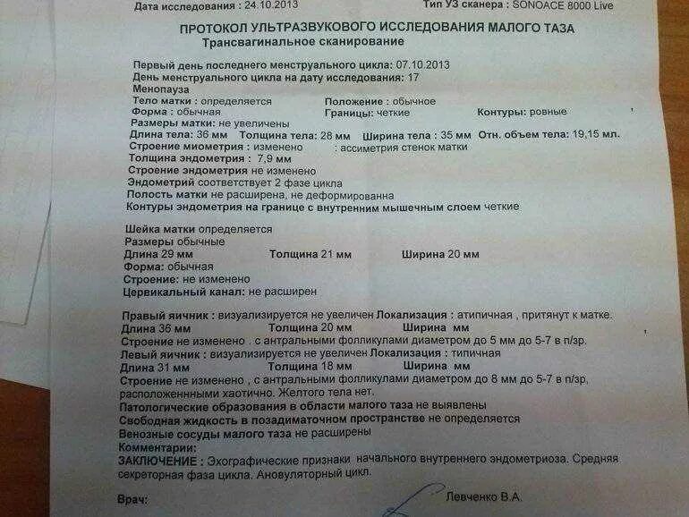 Дают ли инвалидность после удаления матки. Узи матки норма протокол. протокол узи гинекологии норма. заключение узи малого таза при беременности. протокол узи малого таза эндометрия.