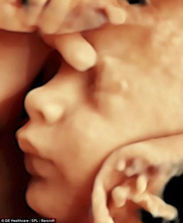Ребёнок в утробе матери 3 d УЗИ. Младенец в утробе 3д УЗИ. 3д снимок ребенка в утробе. Шум в утробе матери