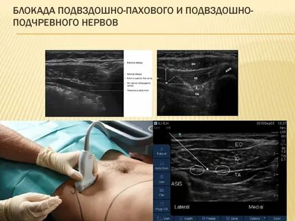 Нервная блокада