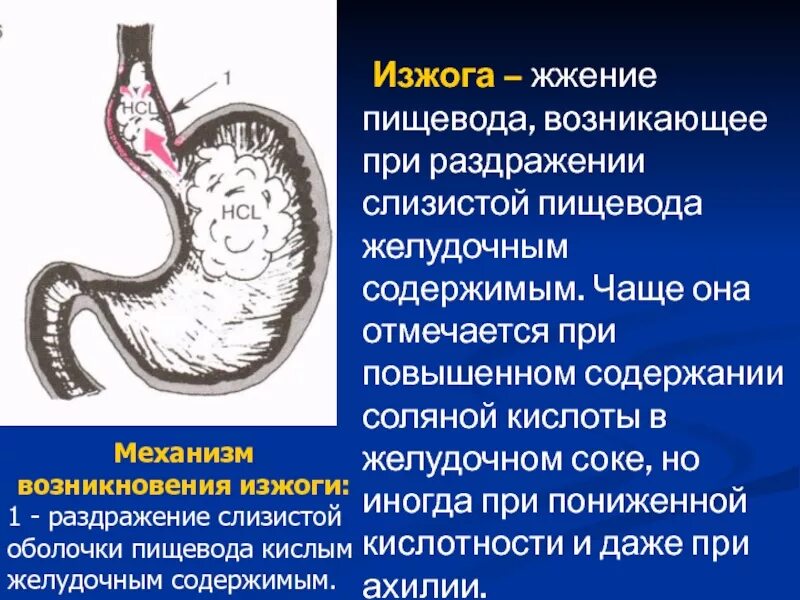 Изжога механизм возникновения. Механизм появления изжоги. Пищевод пищеварительный сок. Кислота в пищеводе лечение