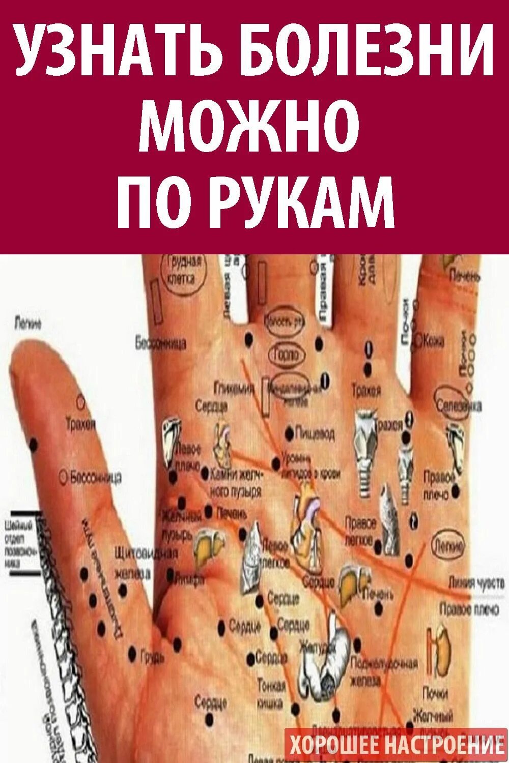 Определить заболевание по рукам. Болезни по ладони. Хиромантия. Болезни по ладони человека. Хиромантия болезни по руке.