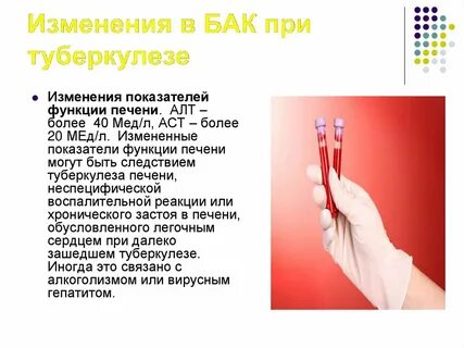 Моча на микобактерии туберкулеза