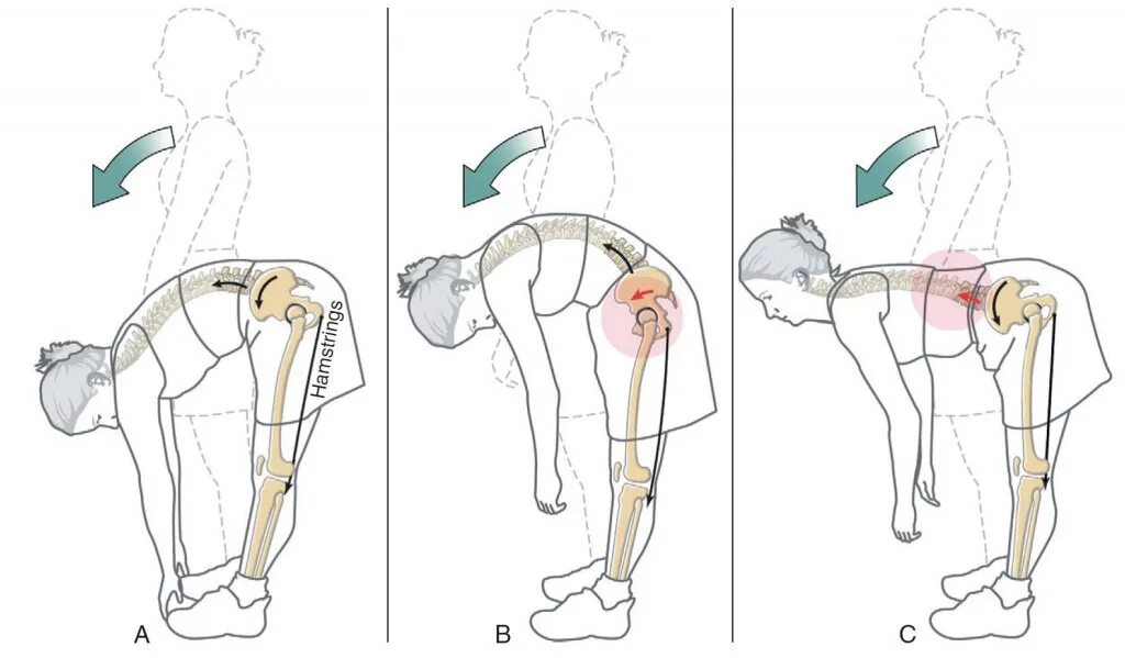 Боль в спине и тазобедренном суставе. Позвоночник в наклоне. Наклон позвоночника вперед. Наклон таза упражнение. Сгибание поясничного отдела позвоночника.
