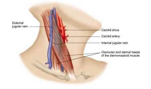 Carotid Sinus.