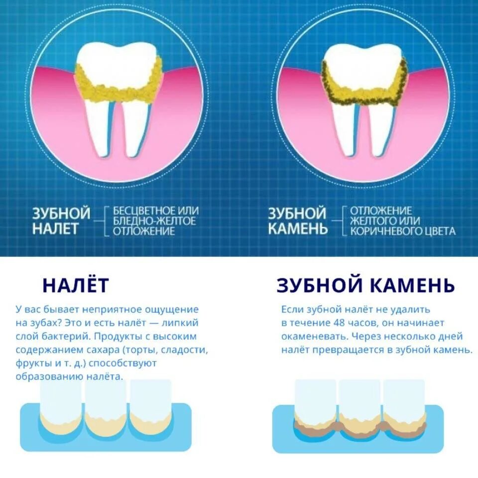 Как удалить зубную в домашних условиях