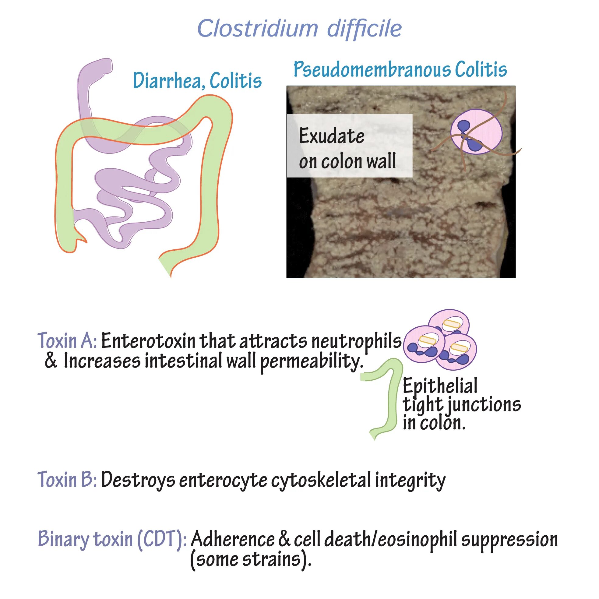 Clostridium difficile что это. Клостридия диффициле путь передачи. Clostridioides difficile питательная среда. Клостридии диффициле ассоциированные инфекции пути передачи. Clostridioides difficile культуральные свойства.