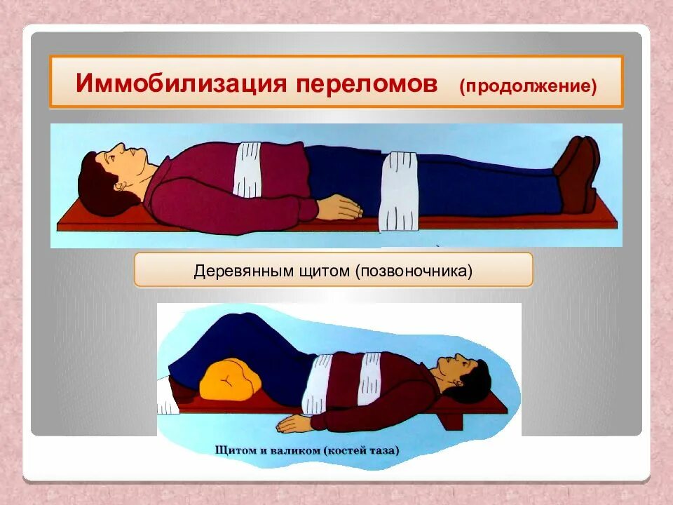 Алгоритм оказания первой помощи при массовых поражениях. Иммобилизация при переломе позвоночника. Стенд по оказанию первой медицинской помощи. Стенд по оказанию первой доврачебной помощи. Порядок действий при оказании первой помощи при травматическом шоке.