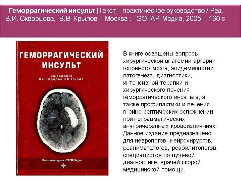 Инвалидность после инсульта. Инвалидность после геморрагического инсульта. Группа инвалидности после инсульта. Оформление инвалидности по инсульту.