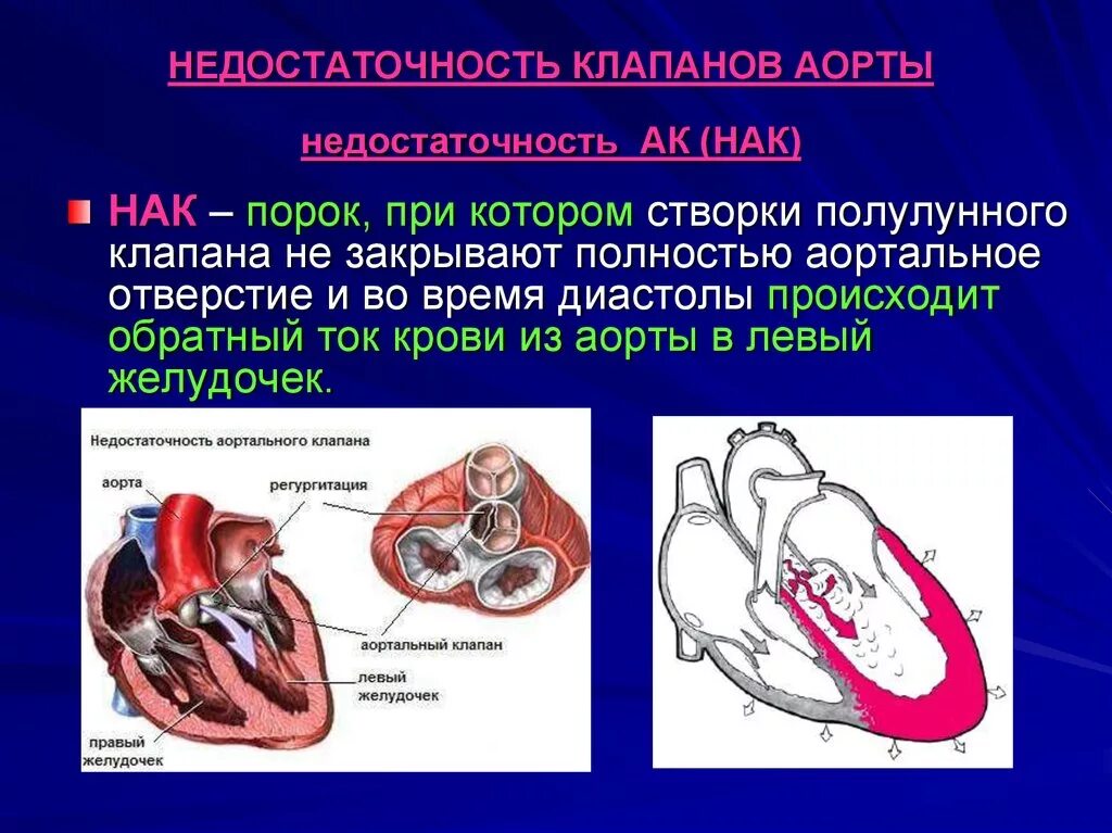 Порок сердца и сердечная недостаточность