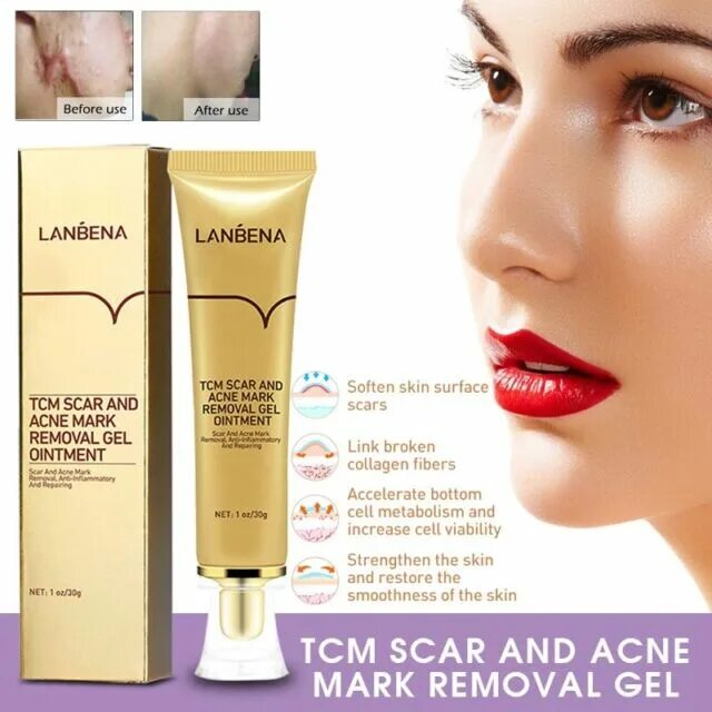 Ointment перевод. LANBENA TCM scar and acne Mark removal Gel Ointment. LANBENA TCM scar and acne Mark removal Gel Ointment отзывы.