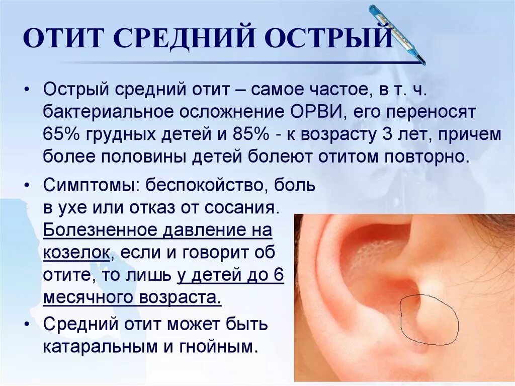 Сколько лечить отит. Средний и наружный отит симптомы. воспаление наружного уха. воспаление среднего уха.