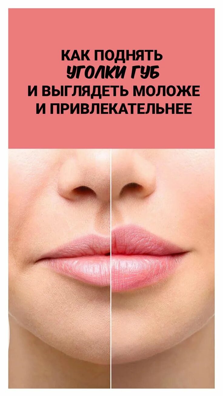 Уголки губ до и после. Белотеро Липс. Belotero Lips 0,6 мл. Формы губ.