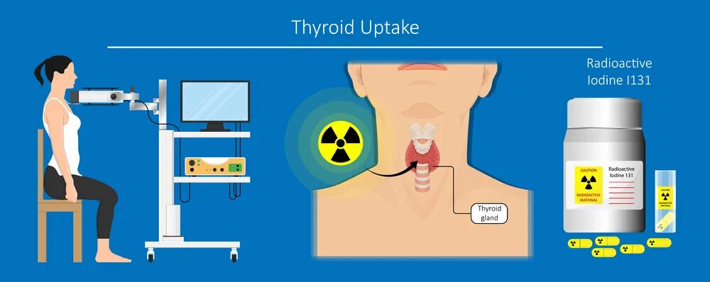 Radioactive Iodine uptake. Радионуклидное сканирование с i131 щитовидка. Iodine 131. Radioiodine Therapy картинки. Радиотерапия щитовидной