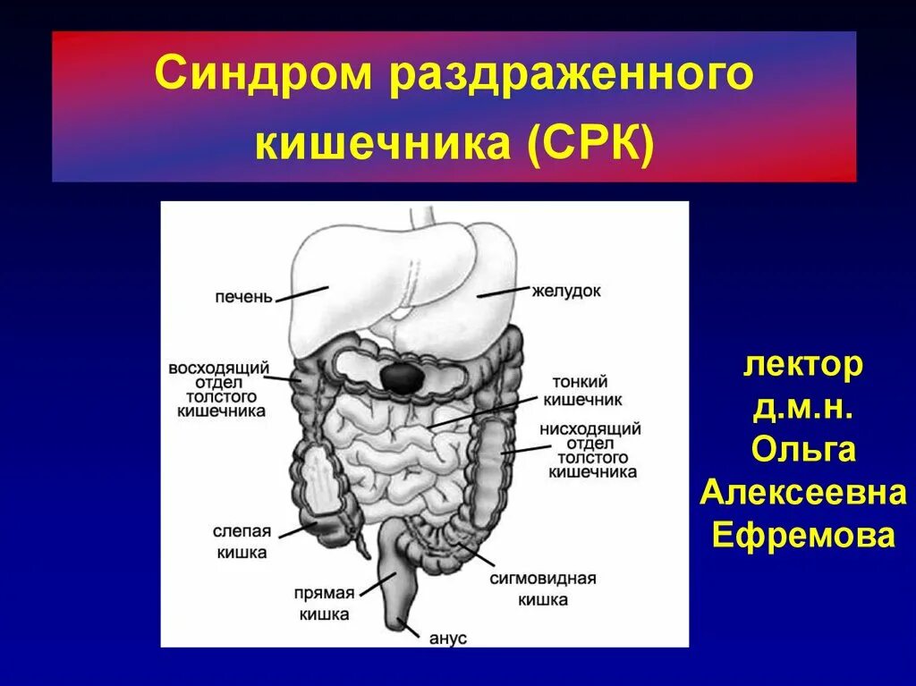 Признаки синдрома раздраженного кишечника симптомы. Внекишечные проявления срк. синдром раздраженного кишечника (срк). синдром раздраженной толстой кишки. раздражение тонкого кишечника.