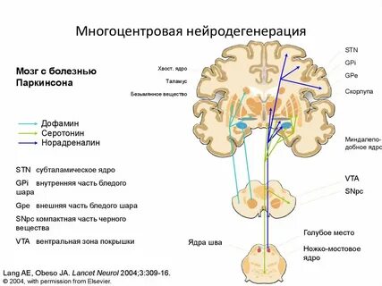Мозжечок после инсульта