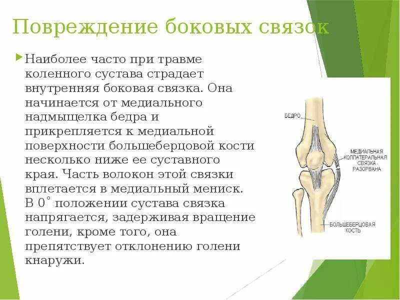 Как лечить повреждения коленного сустава. Боковые связки коленного сустава. внутренняя боковая связка коленного сустава. разрыв боковой связки колена. надмыщелок бедренной кости.