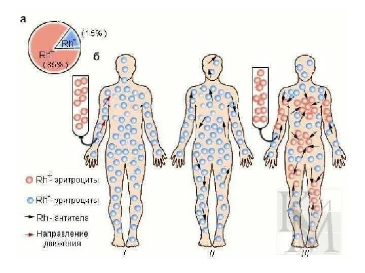 Резус фактор при переливании крови. Резус конфликт при переливании. Конфликт резус факторов при переливании. Резус конфликт при гемотрансфузии.